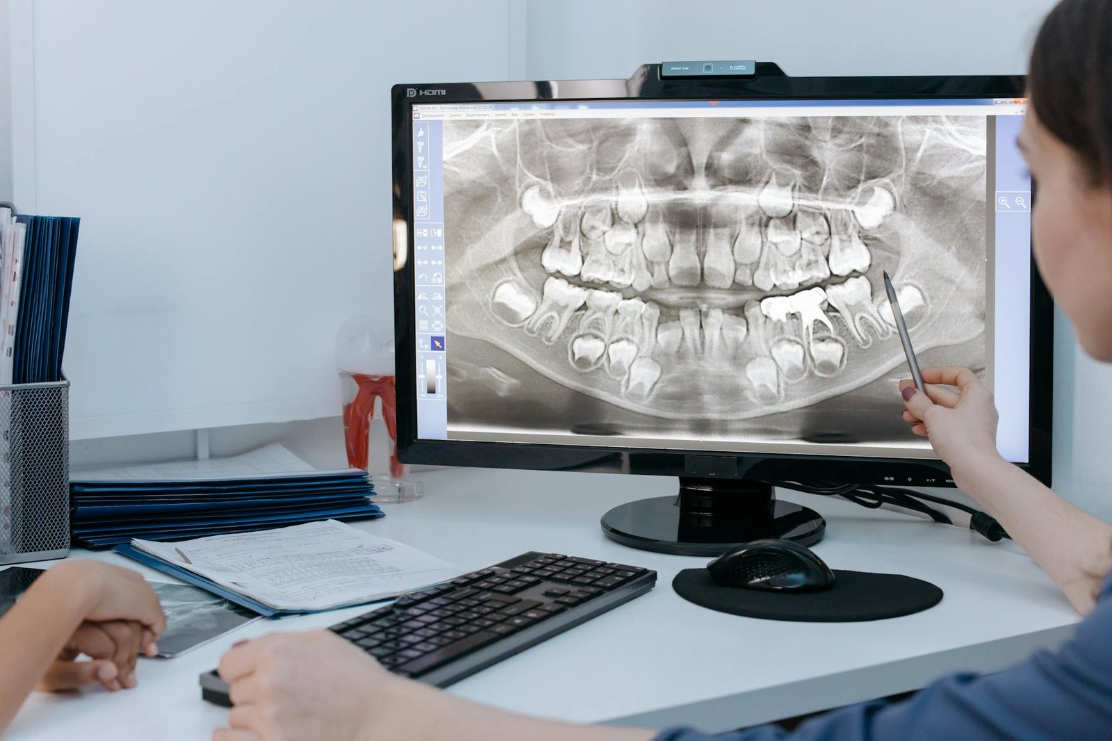 Illustration of Kids Dental Xray Age Guide: Must-Have Tips from Pediatric Dentist Maharashtra